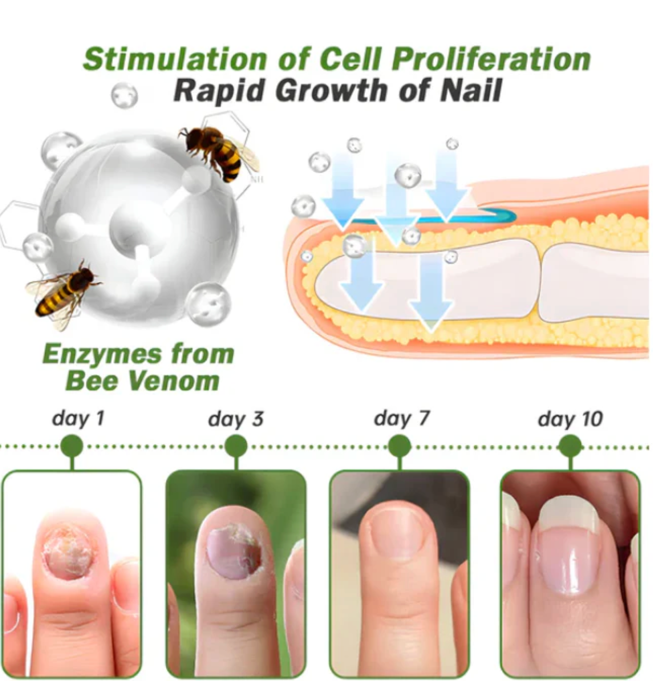 Flysmus - Suero para tratamiento de uñas con veneno de abeja OFERTA 2X1 ✅