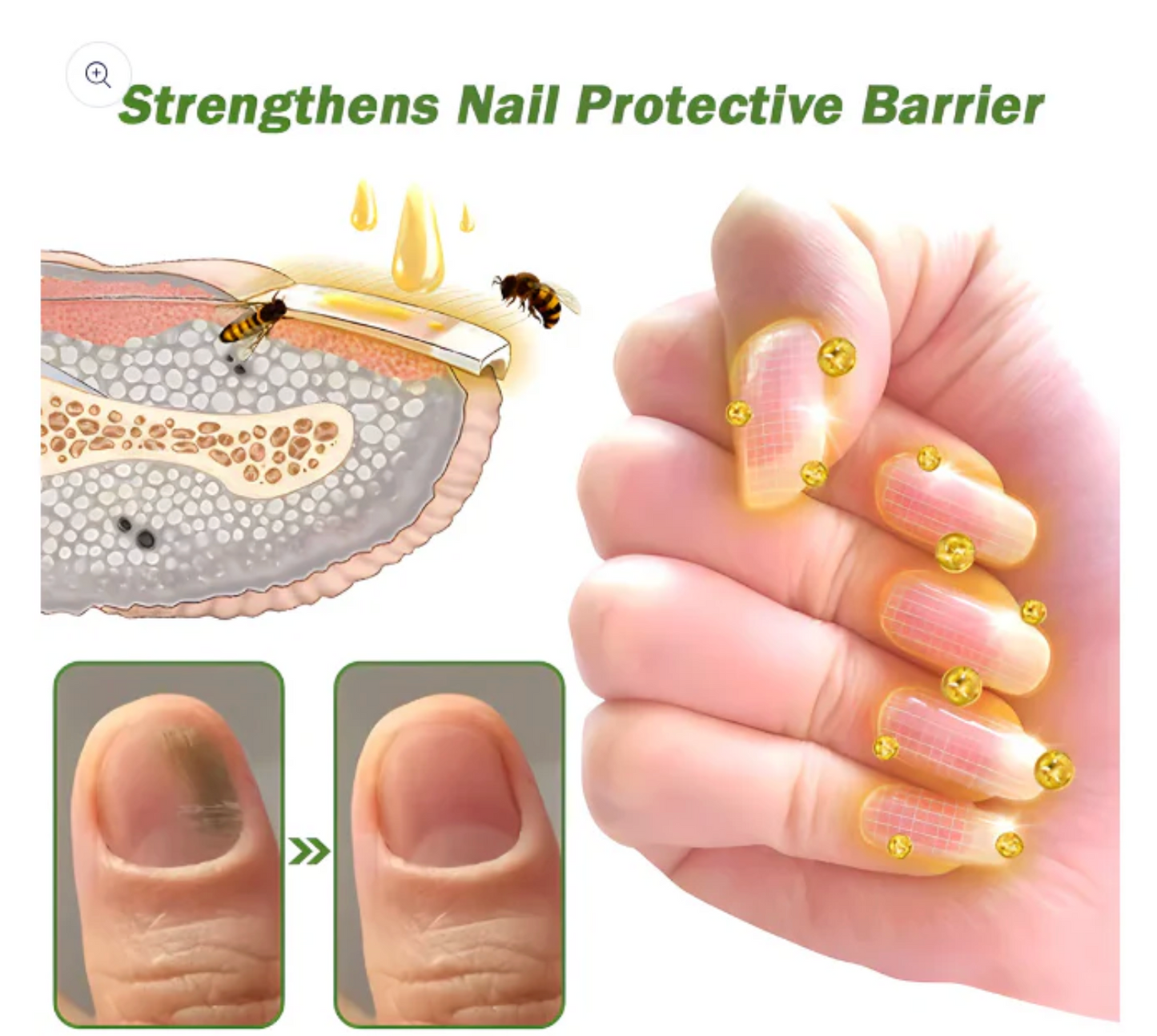 Flysmus - Suero para tratamiento de uñas con veneno de abeja OFERTA 2X1 ✅