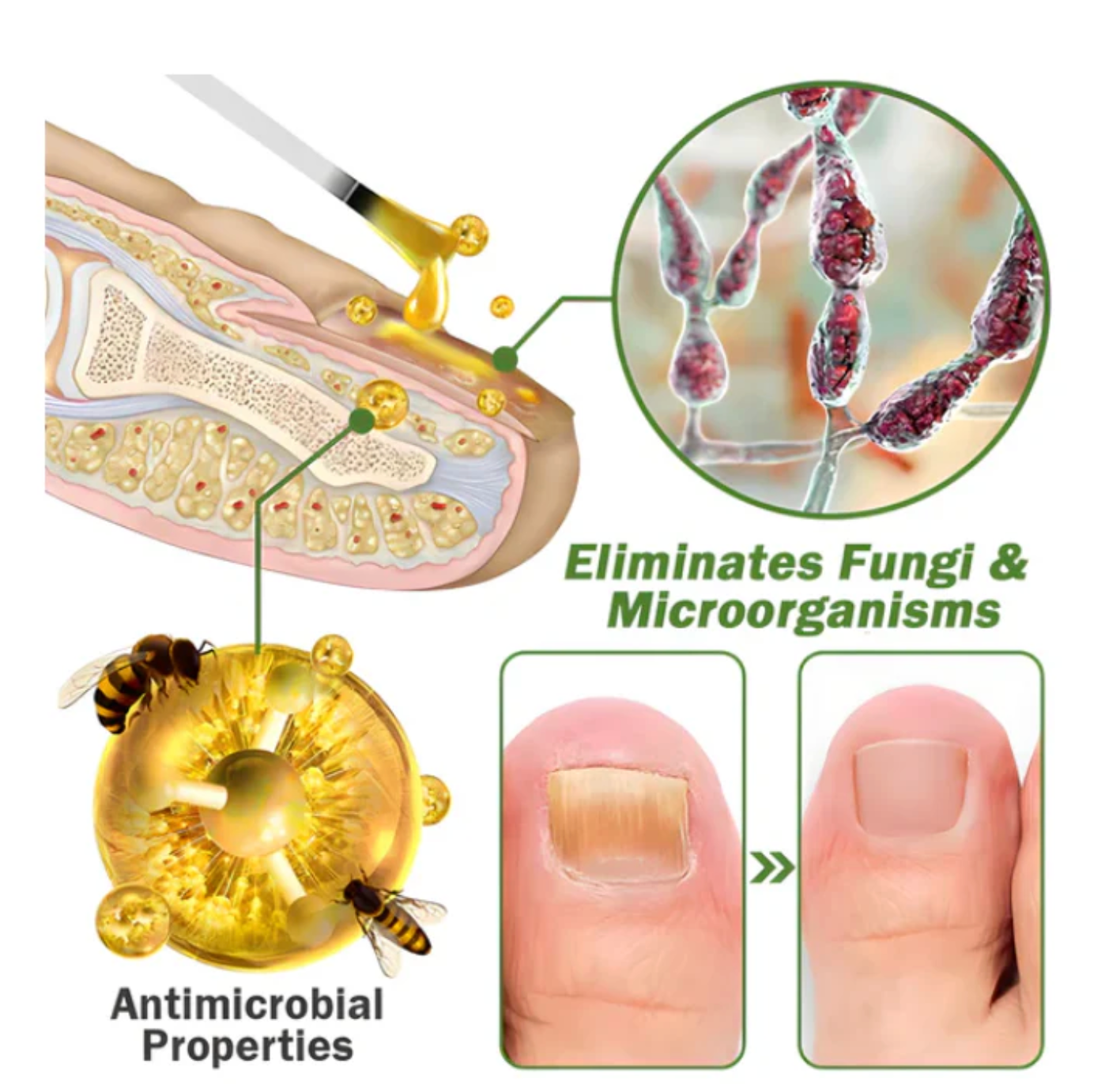 Flysmus - Suero para tratamiento de uñas con veneno de abeja OFERTA 2X1 ✅