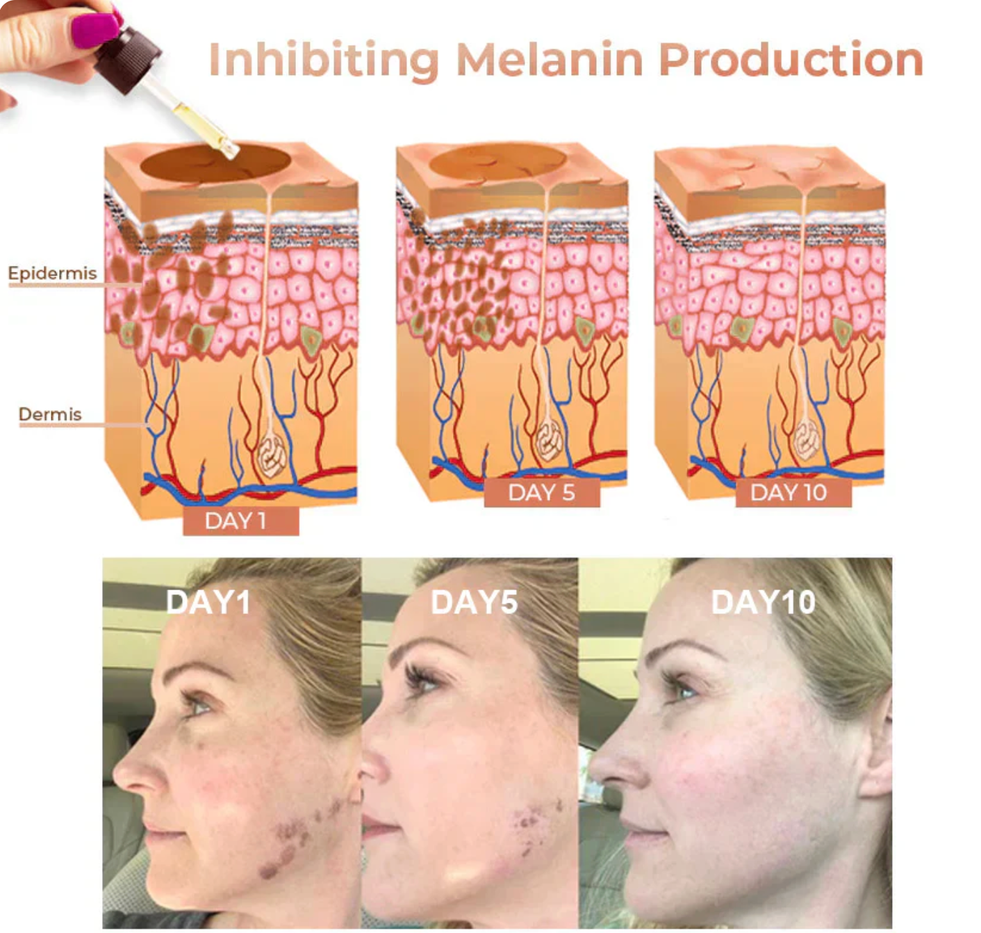✨Quitamanchas Rápidas-Dobshow™ Suero Facial Corrector de Melanina- LLEVA EL 2DO CON UN 50% DE DESCUENTO🔥✅