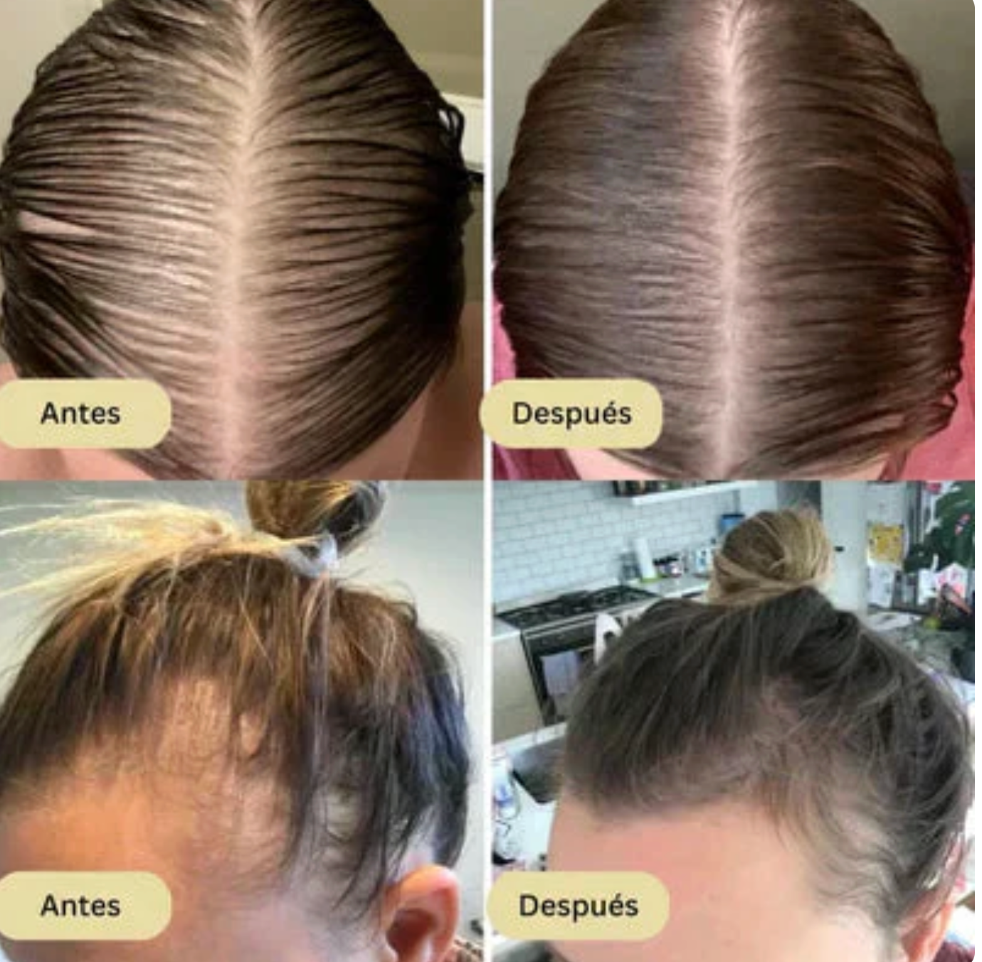 Vitaorganic - Aceite Para El Crecimiento del Cabello 🌿 OFERTA 2X1 ✅