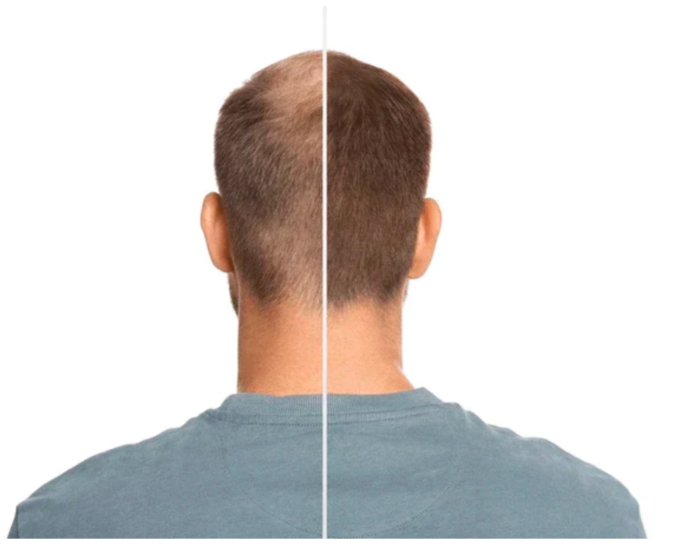 Vitaorganic - Aceite Para El Crecimiento del Cabello 🌿 OFERTA 2X1 ✅