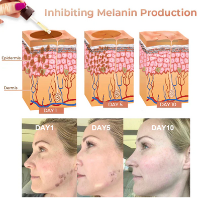✨Quitamanchas Rápidas-Dobshow™ Suero Facial Corrector de Melanina- LLEVA EL 2DO CON UN 50% DE DESCUENTO🔥✅