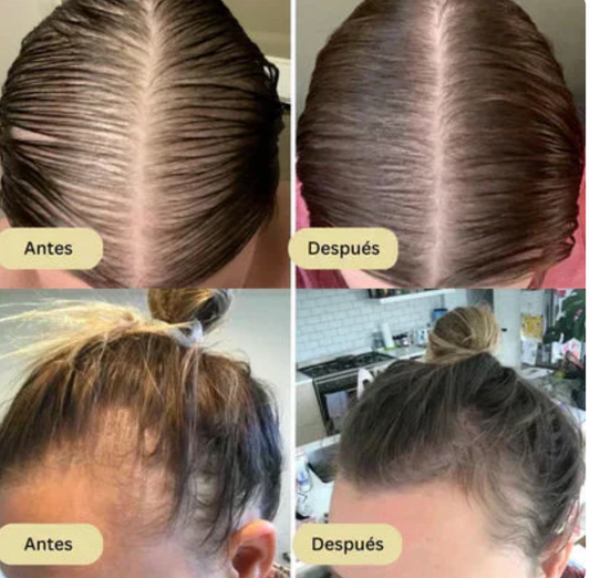 Vitaorganic - Aceite Para El Crecimiento del Cabello 🌿 OFERTA 2X1 ✅